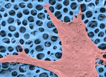 Image of a cell growing on an artificial scaffold, developed at Swansea University, which could be used for wound healing 